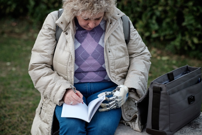 Una mano bionica per una donna del Veneto. È la prima italiana