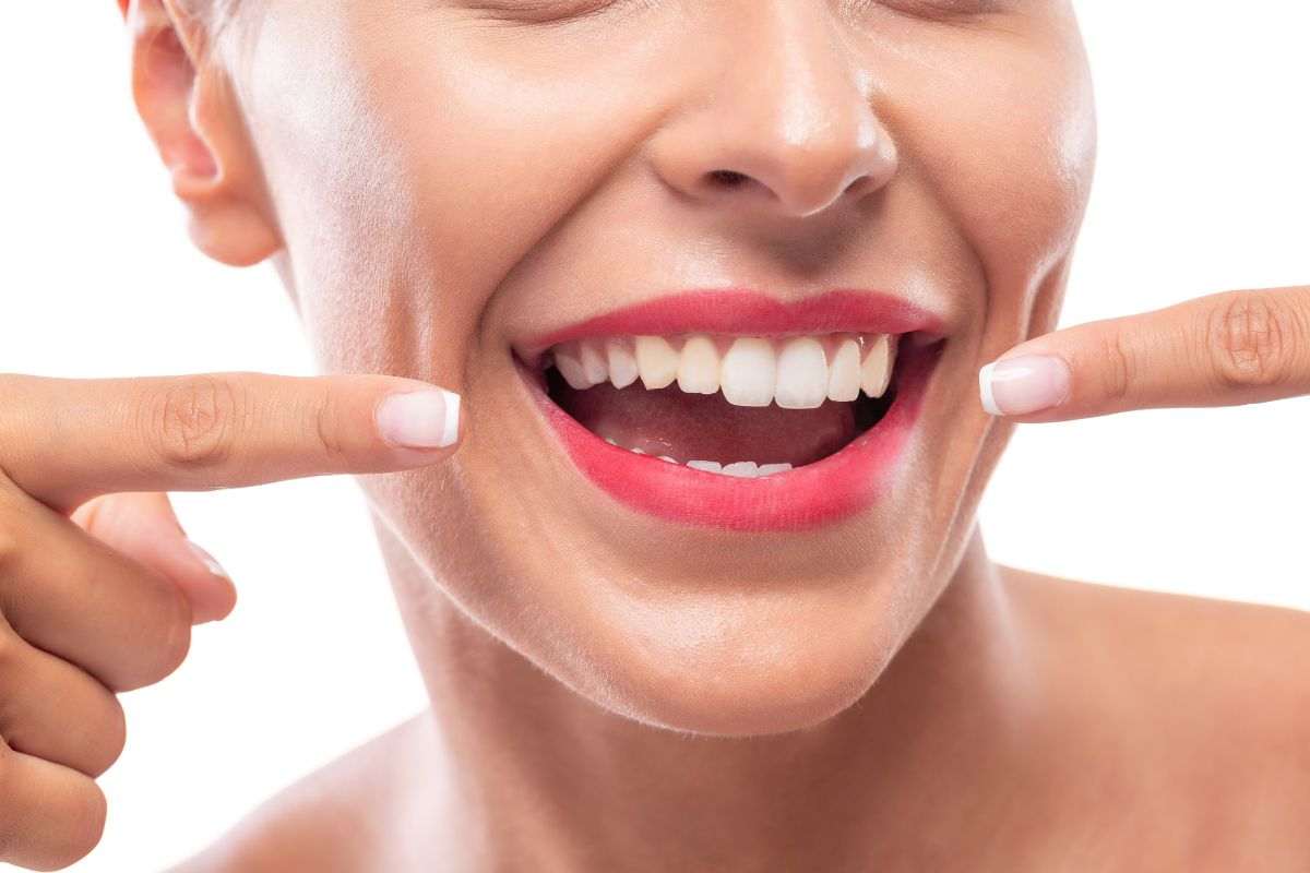 ottenere denti bianchi