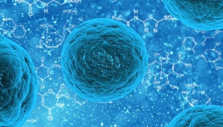 cos'è la leucemia mielomonocitica di cui soffriva berlusconi