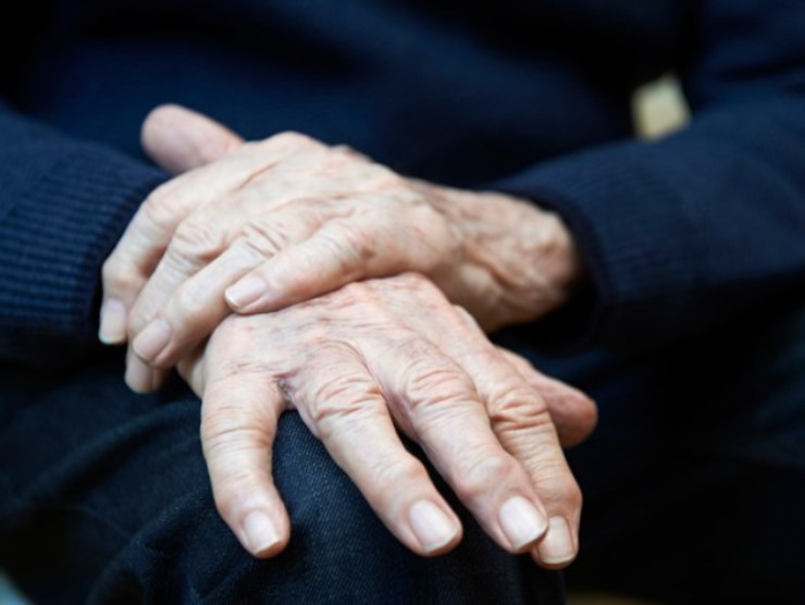 Analisi 3D sconfiggere Parkinson