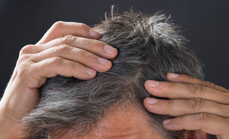 cadono i capelli e come fare a prevenirne la perdita