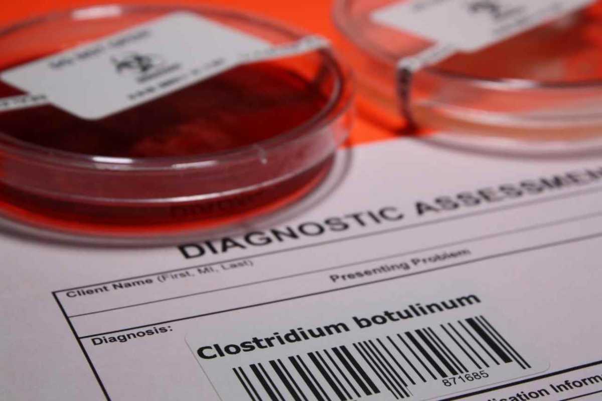 cos'è il botulino batterio