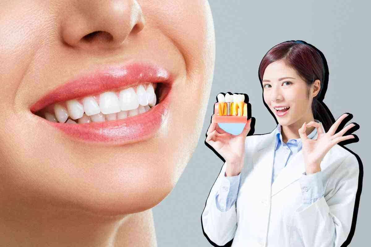 Igiene dentale: quando farla