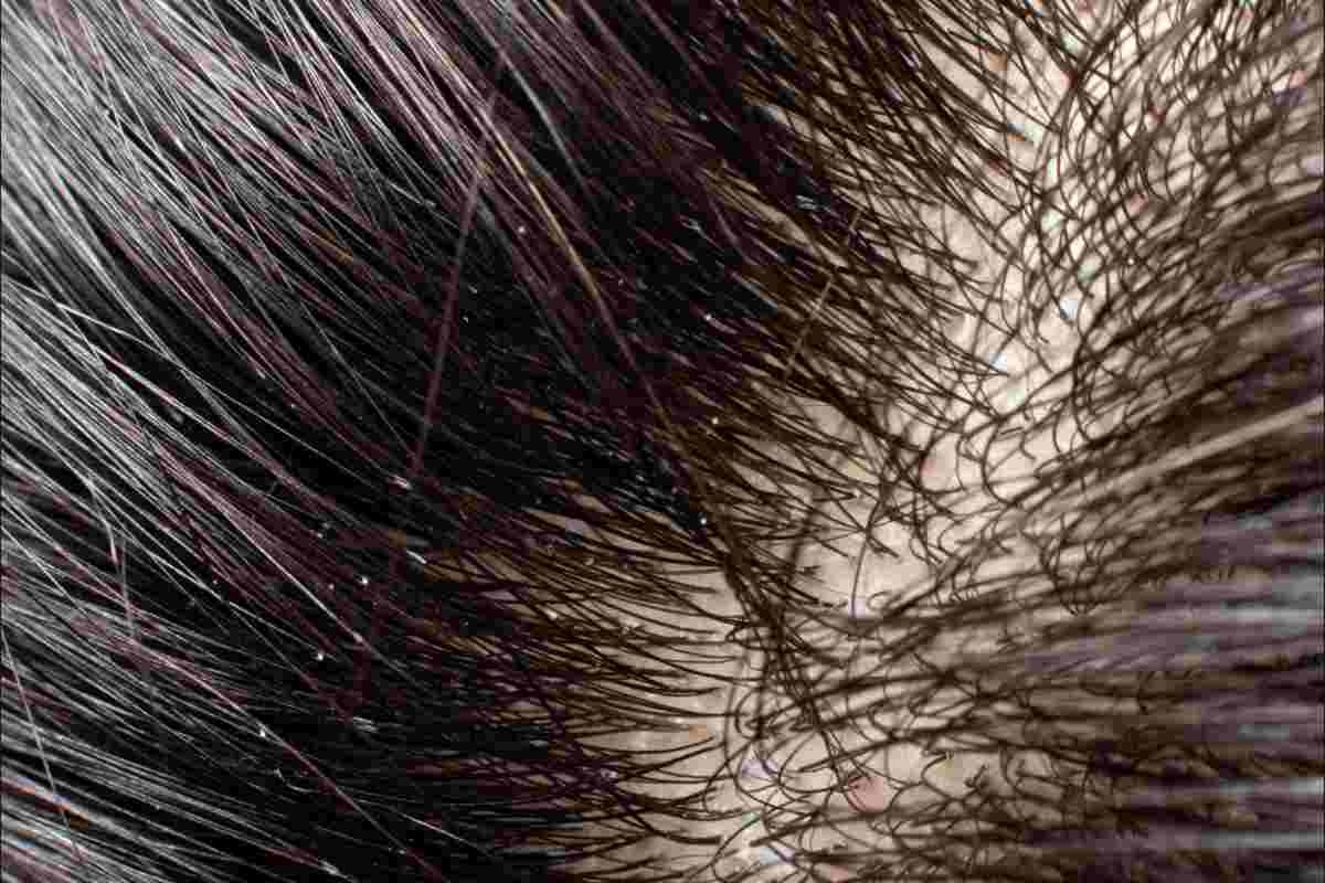 problema capelli sporchi