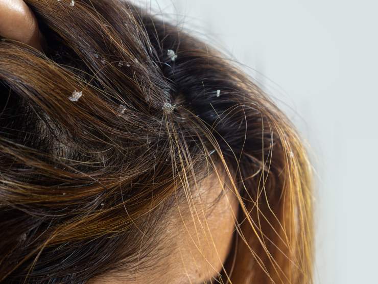 rimedi capelli sporchi