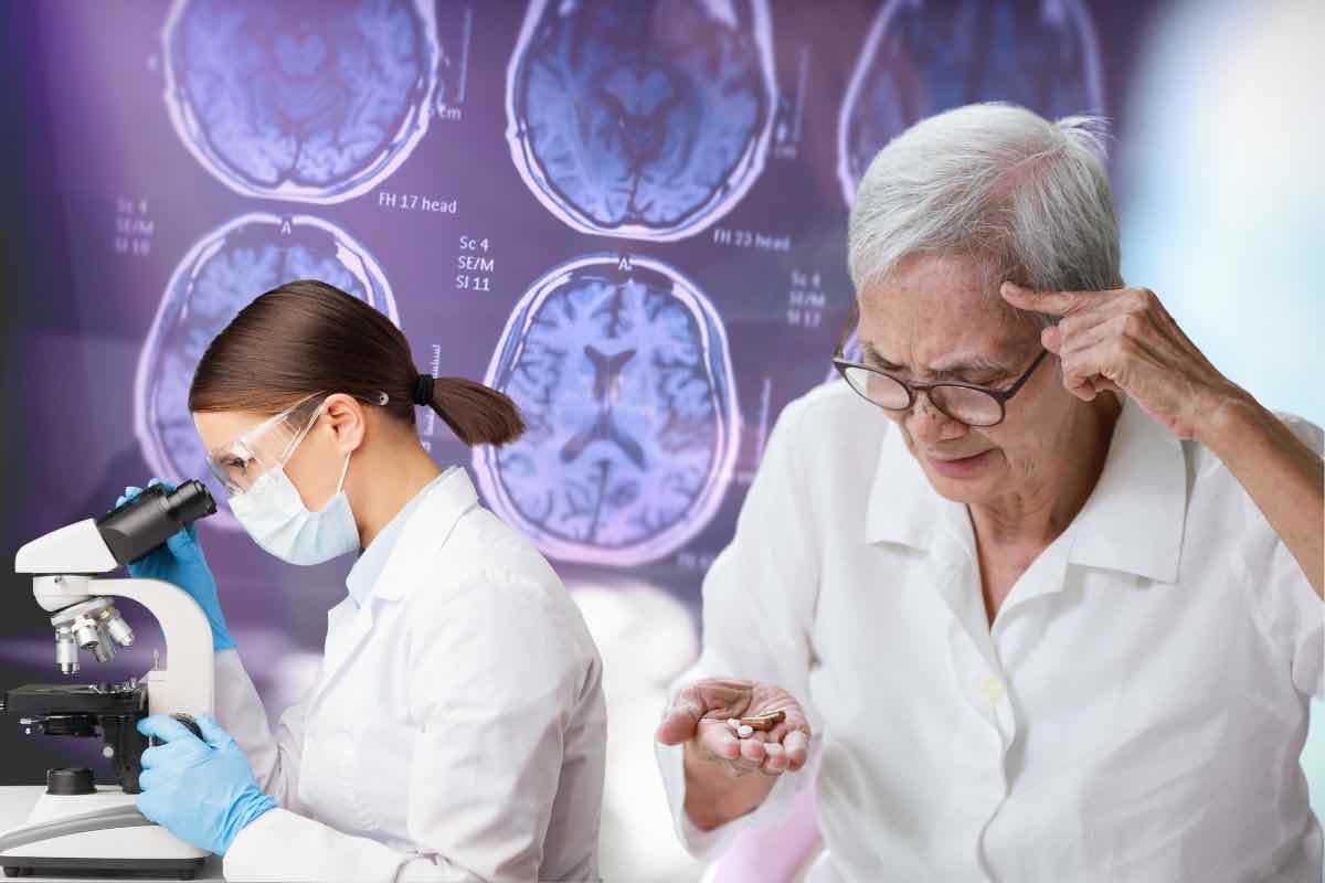 nuova scoperta sull'alzheimer