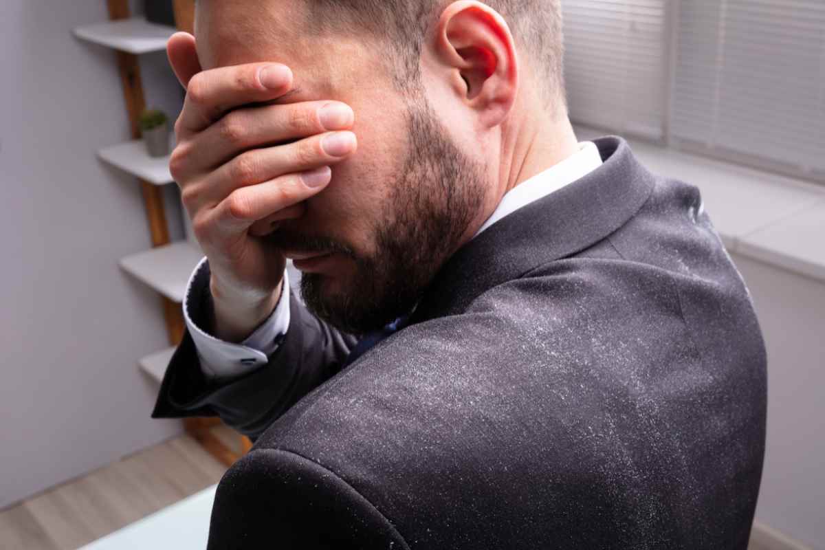 Risolvere problema forfora barba e sopracciglia