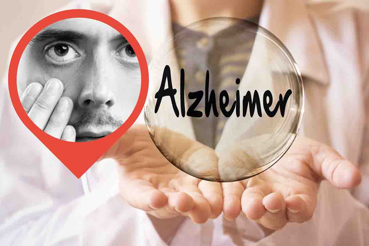 alzheimer primi sintomi occhi