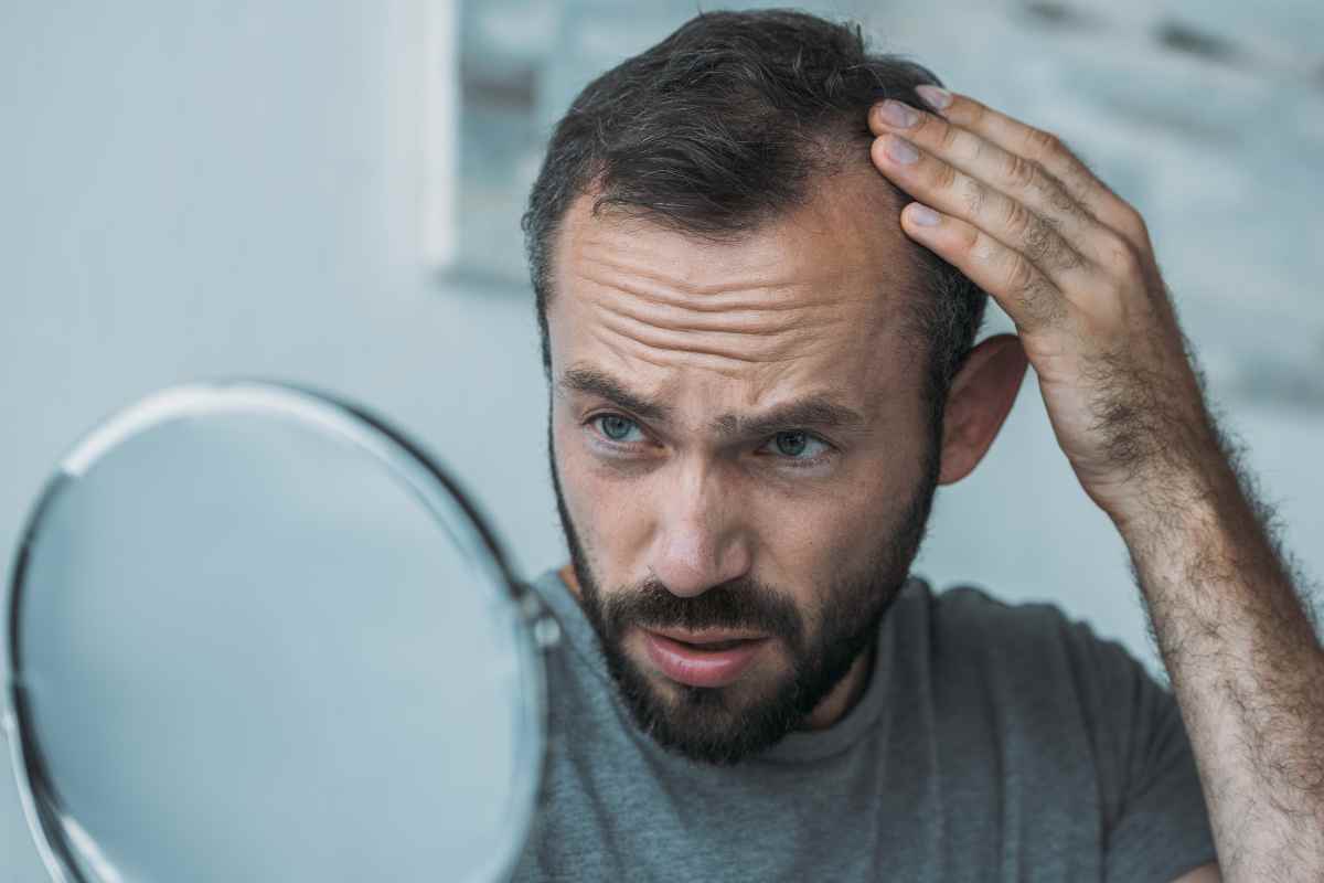 quanti capelli si possono perdere normalmente