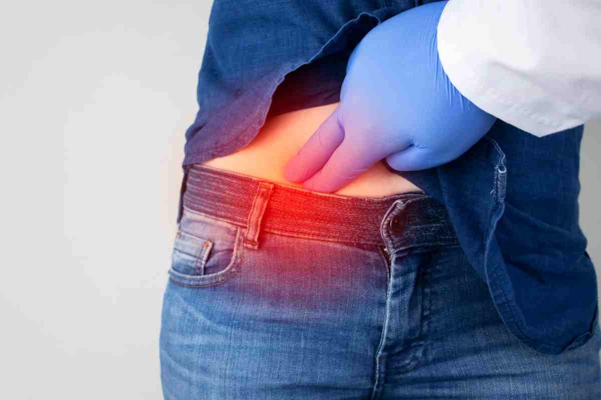 Come riconoscere il morbo di Chron