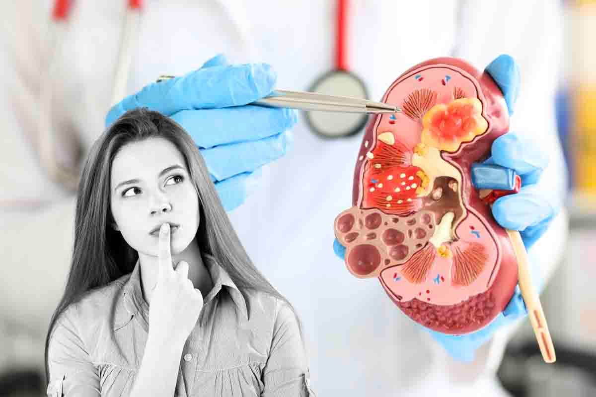 Enfermedad de Crohn: qué es y cómo reconocer una enfermedad cada vez más común y extendida