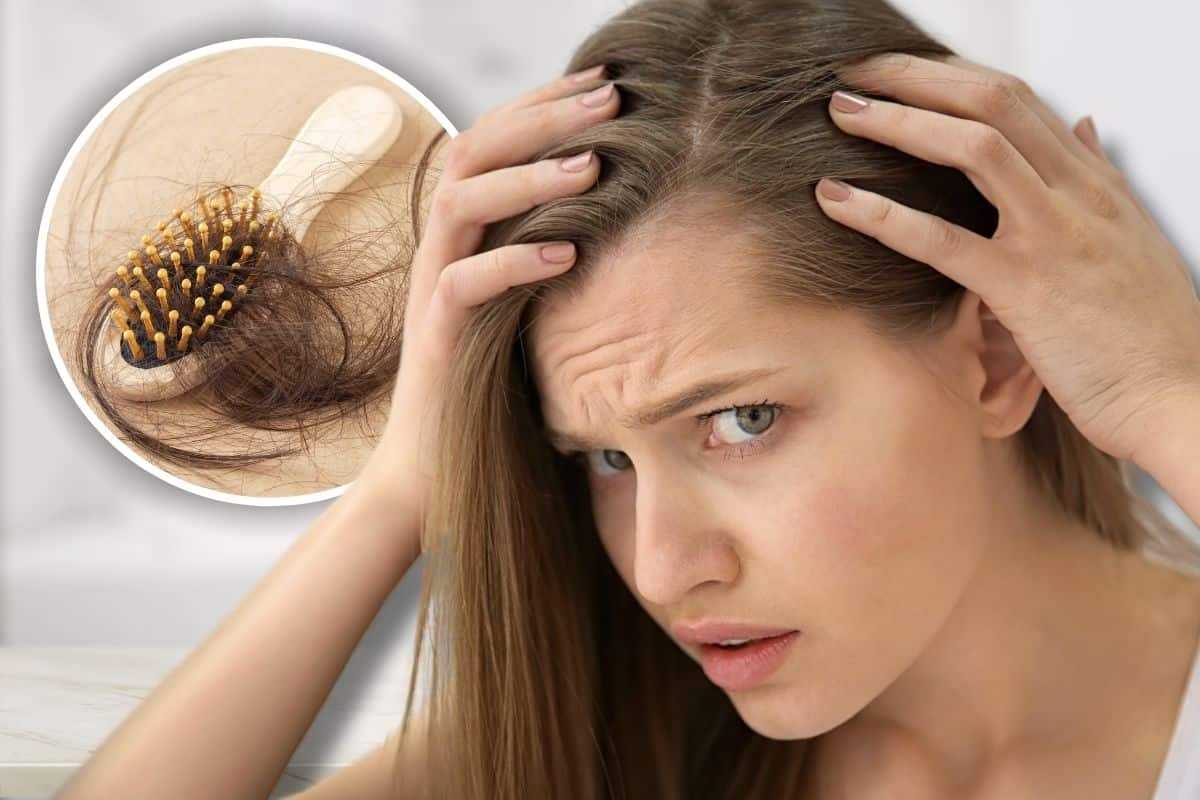 alopecia femminile: cause e trattamenti