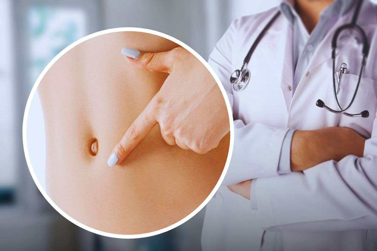 Come capire un problema di salute dall'ombelico