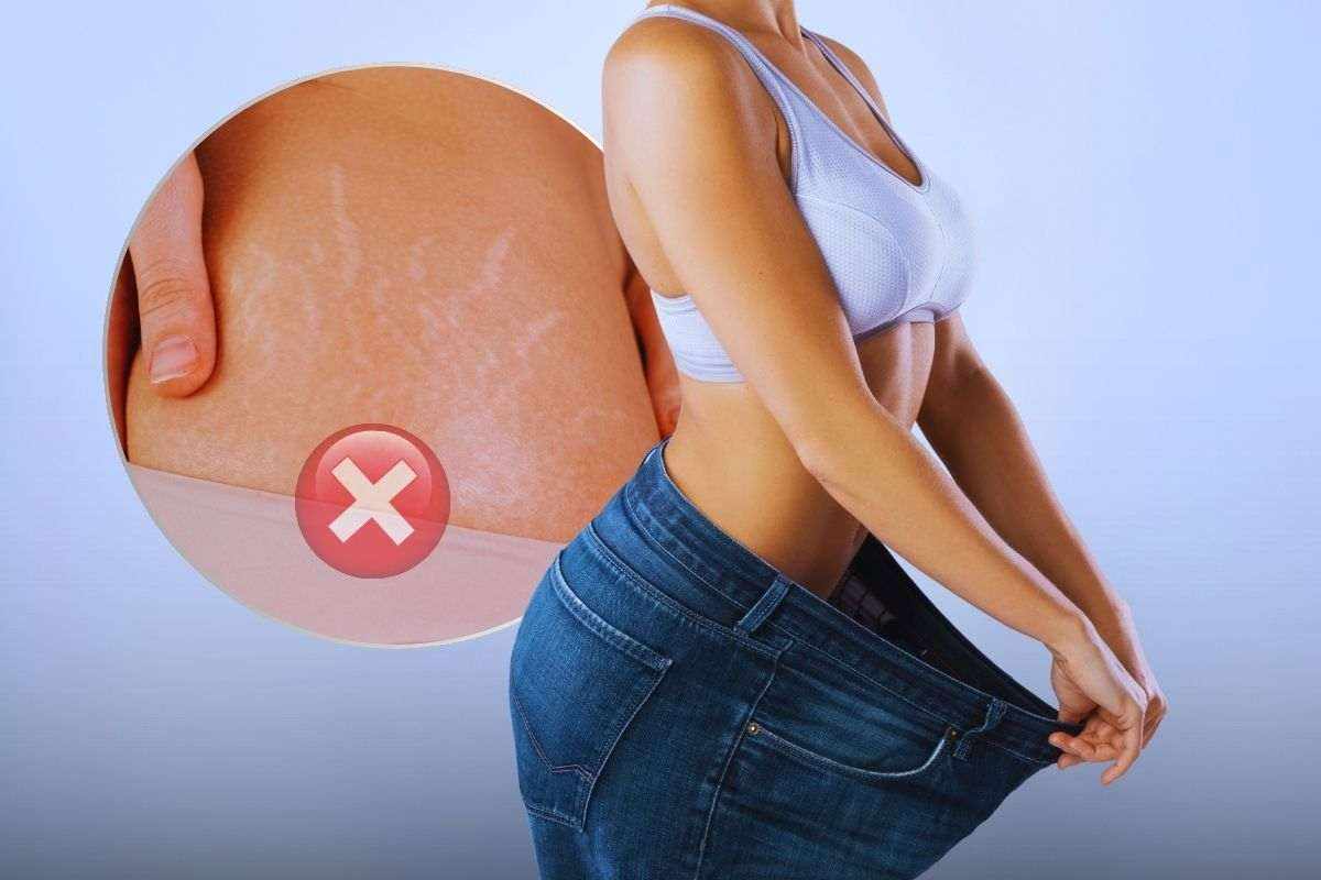 perdere peso senza causare danni a pelle