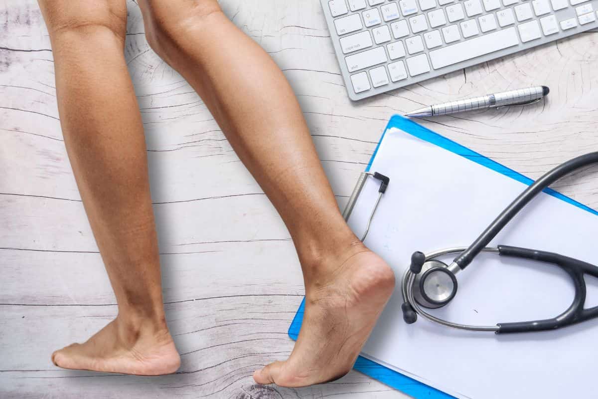 Flat feet, doctors have always made mistakes in their diagnosis: the true consequences are now emerging after the new study