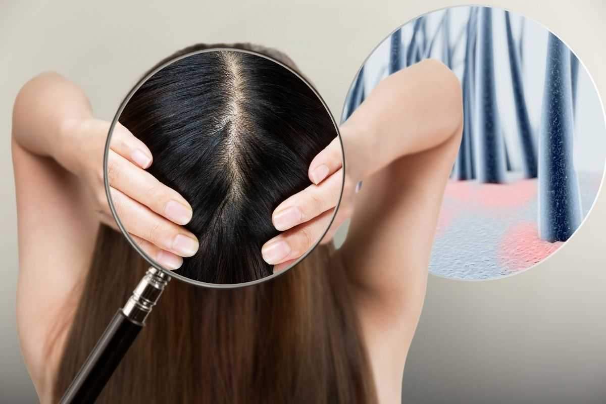 The famous dermatologist says it clearly: This product can harm the scalp
