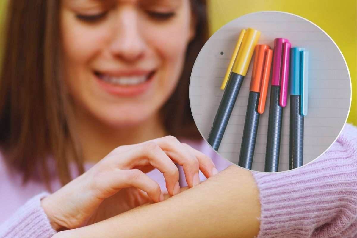 Punture insetto: trucco penna