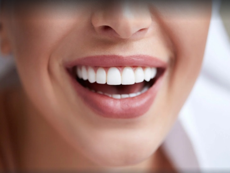denti bianchissimi trucchetti naturali