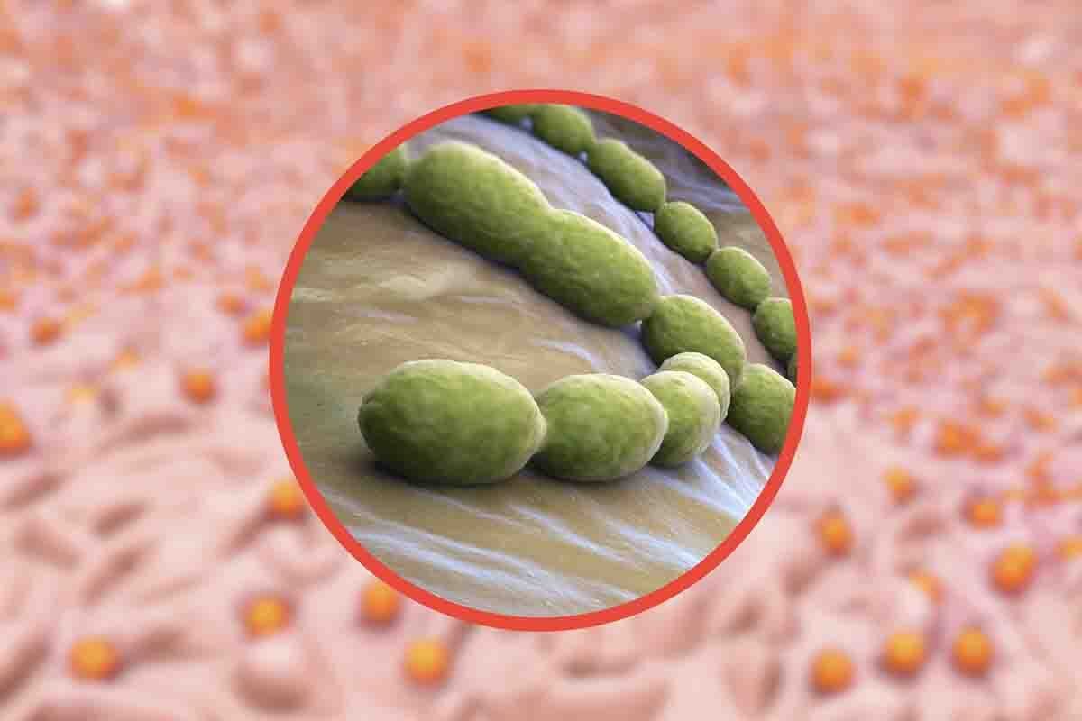 Streptococco: cosa succede in Italia