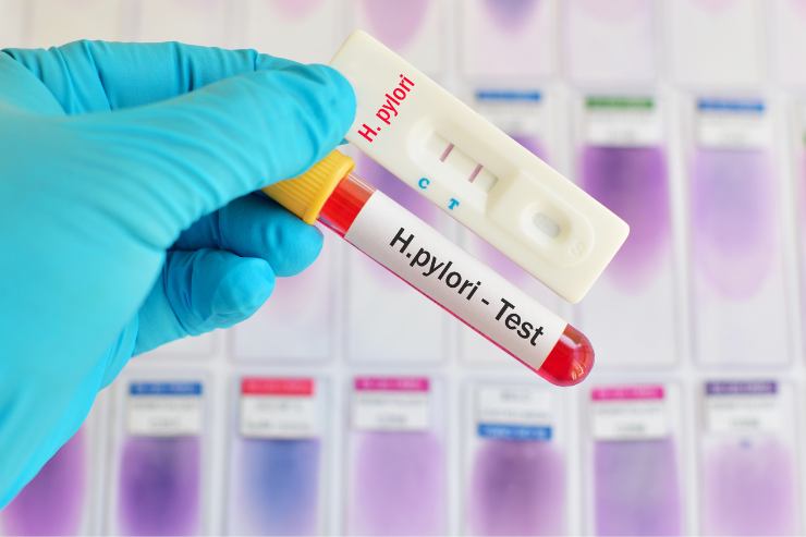 Problemi digestione: batterio porta cancro