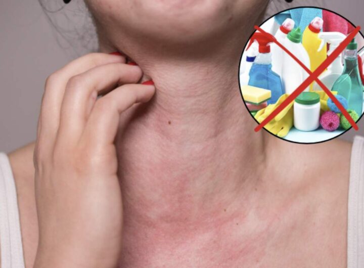 L'uso di detergenti chimici è una delle principali cause di reazioni allergiche