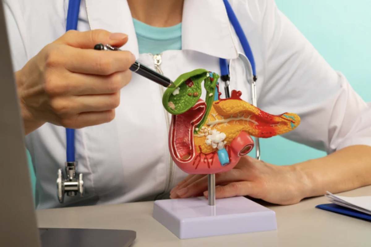 Uno dei principali problemi legati al tumore al pancreas è che i sintomi iniziali sono spesso assenti o molto vaghi