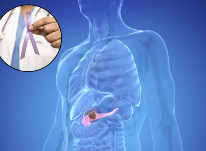Il pancreas è una ghiandola fondamentale per il corpo umano, situata nell'addome, precisamente tra lo stomaco e la colonna vertebrale.