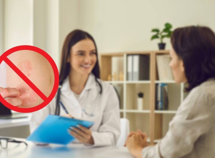 Prodotto innovativo per la psoriasi
