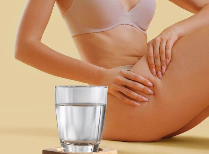 le acque per combattere la cellulite