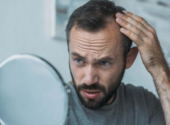 Contro caduta capelli